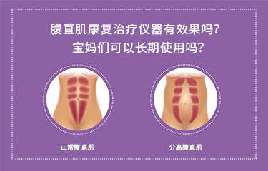 腹直肌康復(fù)治療儀器有效果嗎？寶媽們可以長期使用嗎？