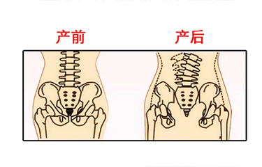 月子期間盆骨儀器修復時間有限制嗎？與手法修復相比哪個效果好？